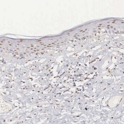 Ubiquitin-activating Enzyme/UBE1 Antibody, Novus Biologicals 0.1mL; Unlabeled:Antibodies,